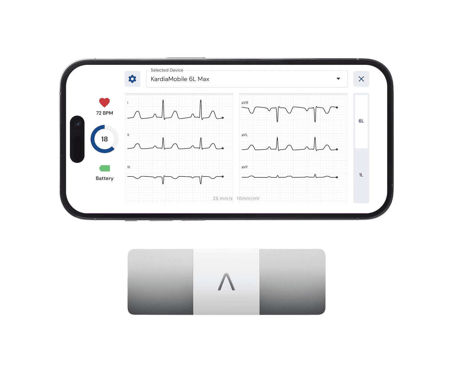 kardiamobile6l max ekg device