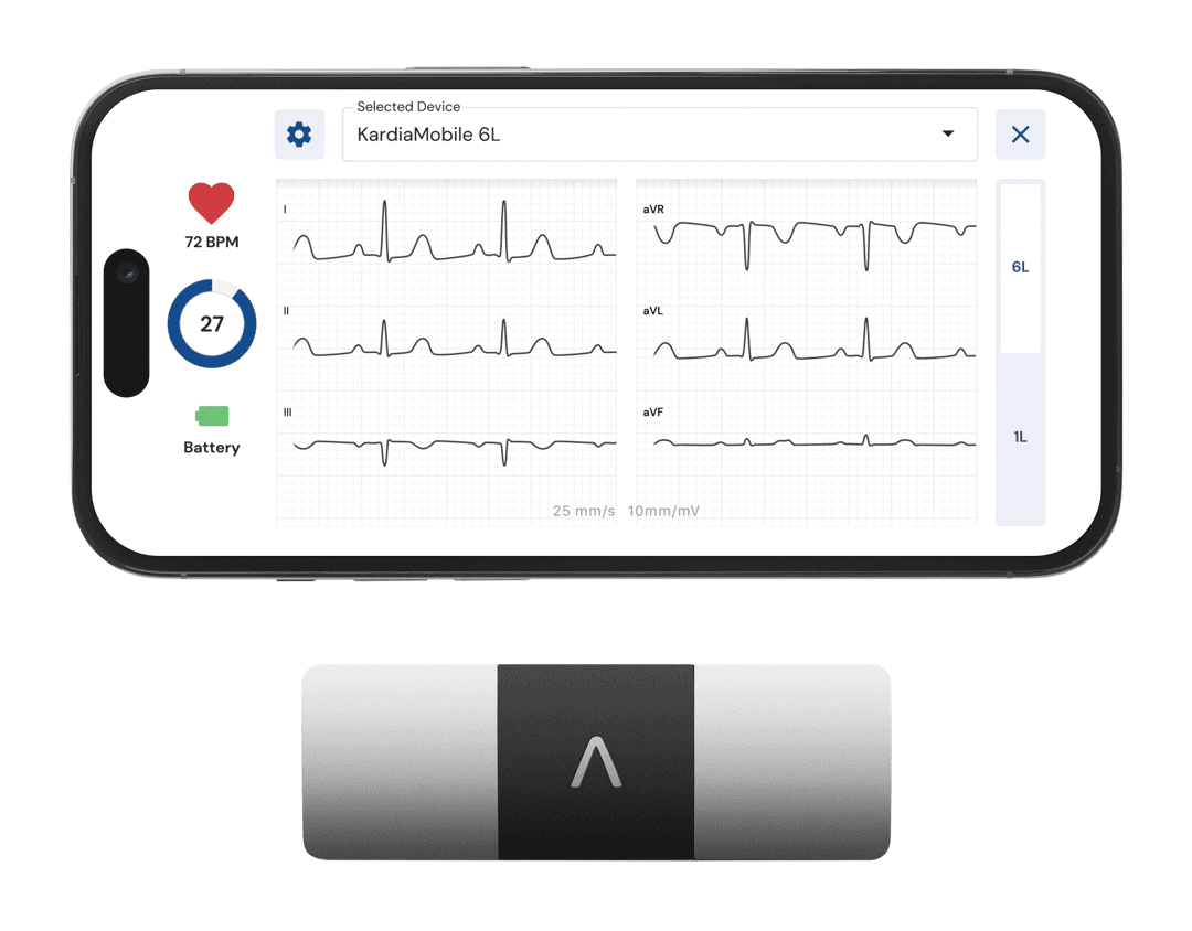 kardiamobile6l six lead ekg device
