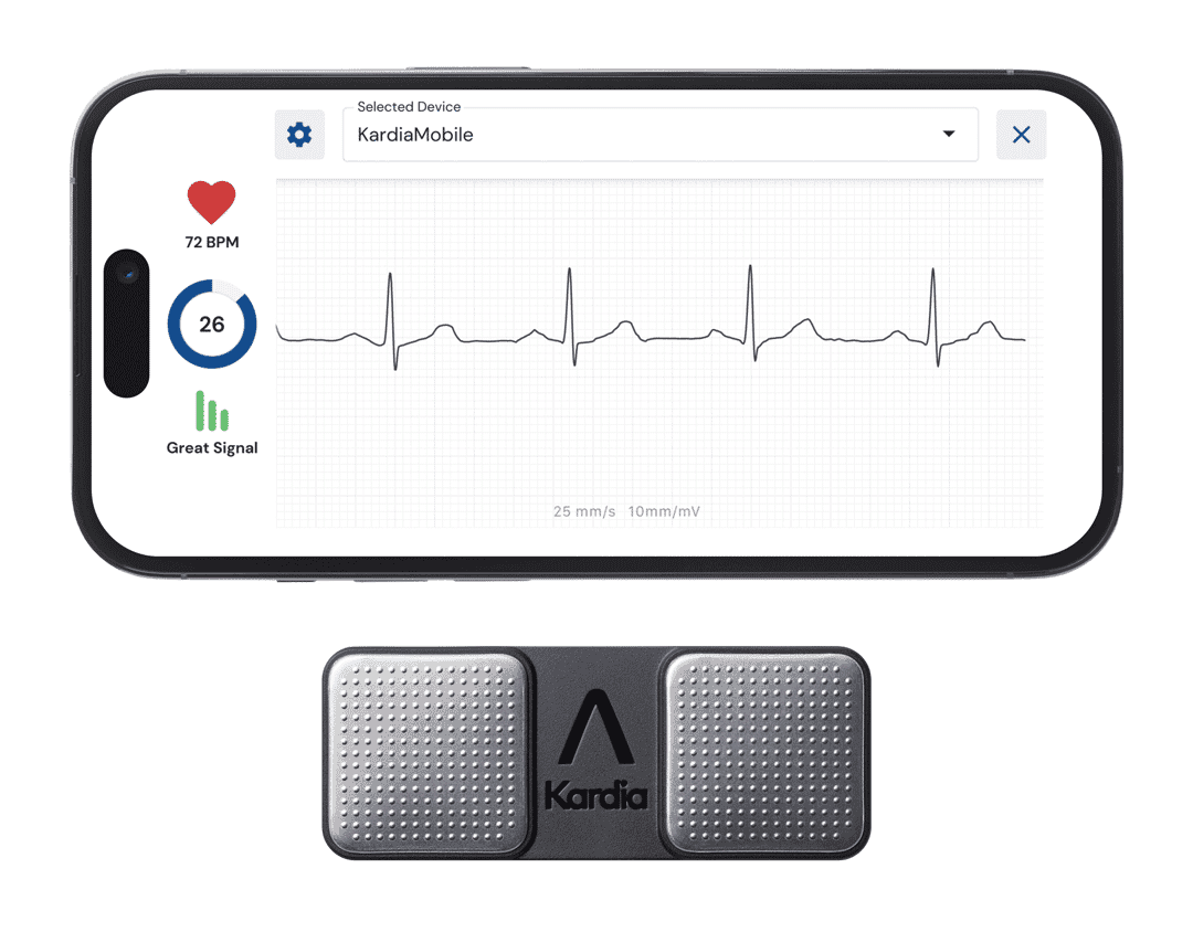 kardiamobile single lead ekg device