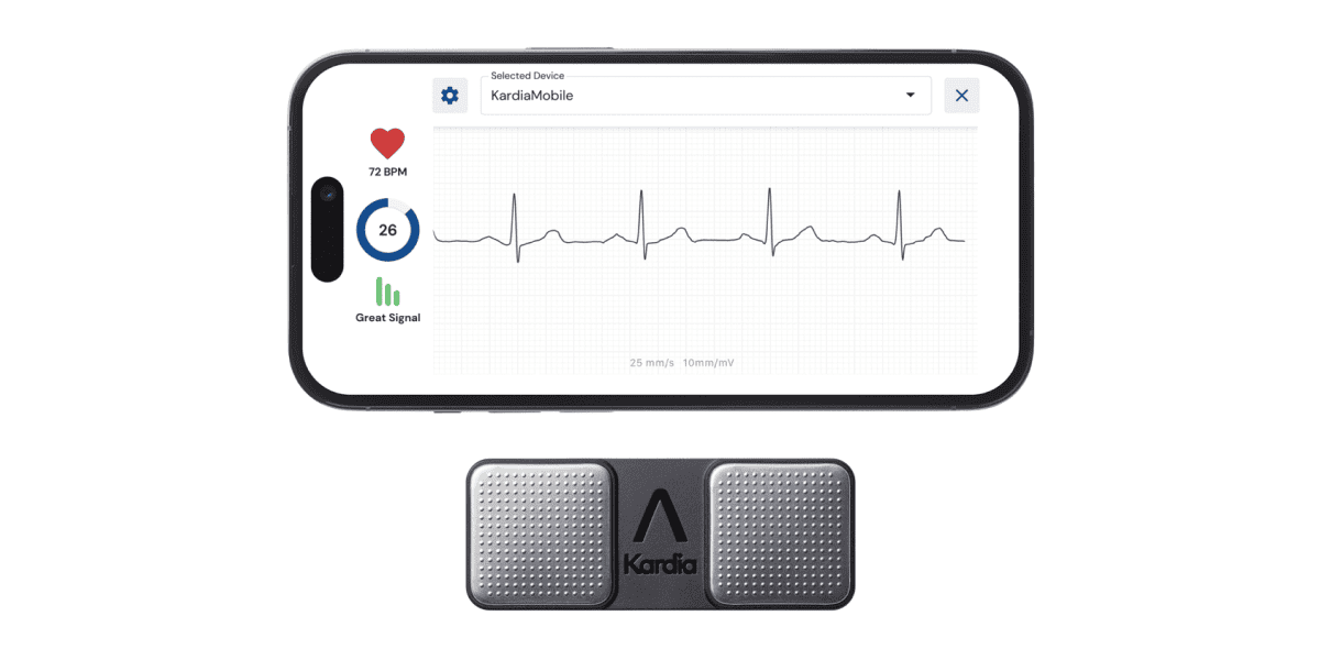 kardiamobile single lead ekg device