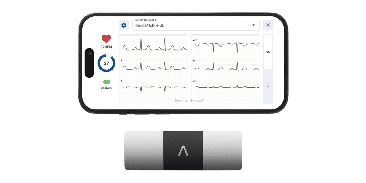 kardiamobile6l six lead ekg device
